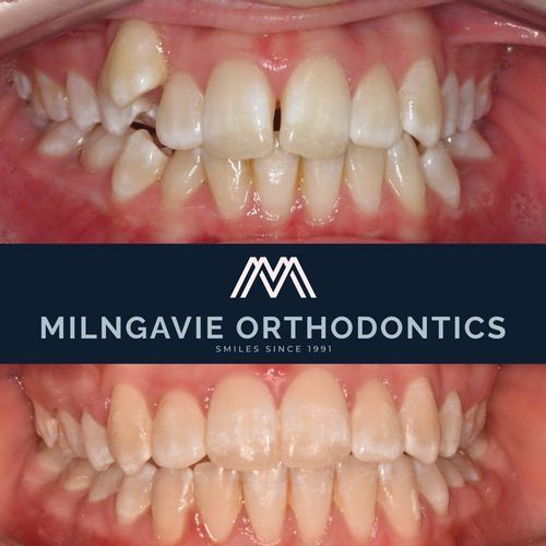 Milngavie Orthodontics